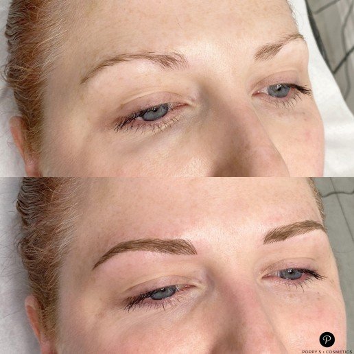 Eyebrow tattoo