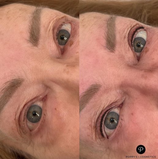 Semi-permanent eyeliner