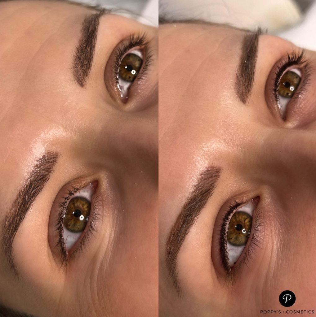 Semi-permanent eyeliner