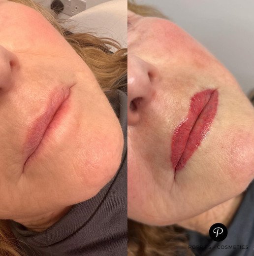 Semi-permanent lip blush