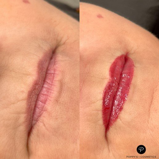 Permanent lip blush