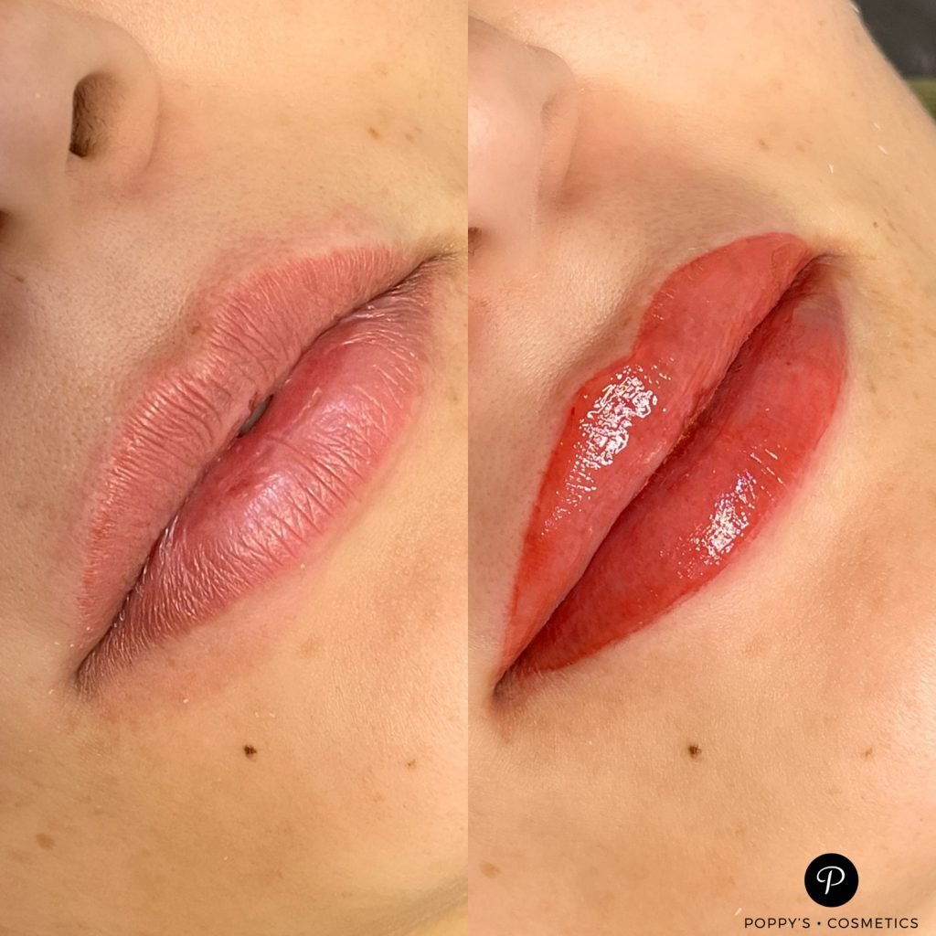 Permanent tattoo lip blush