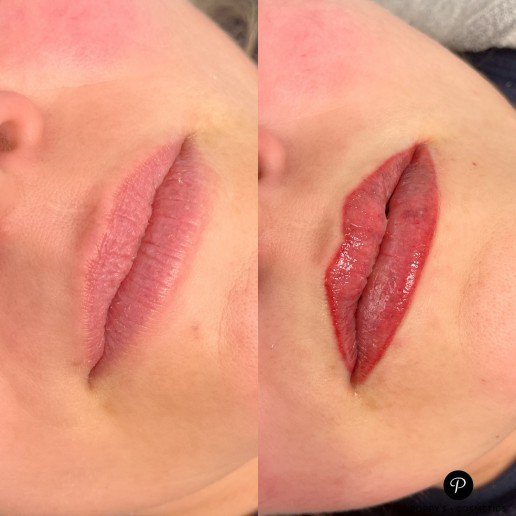 Lip blush